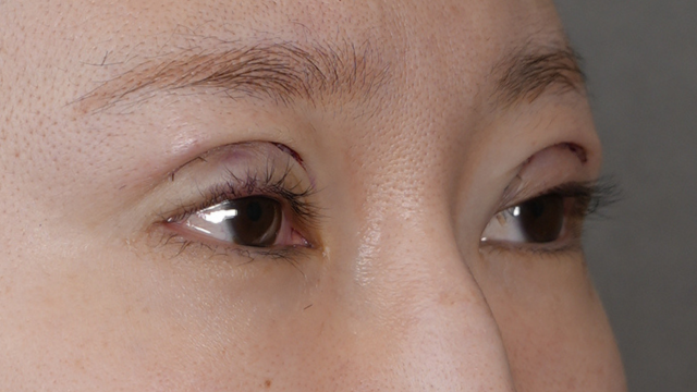 Postoperative Condition Part 1