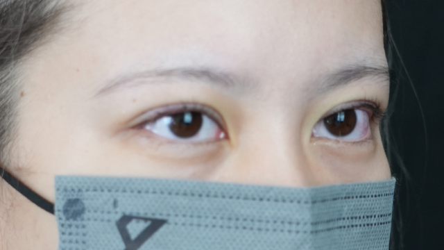 Postoperative Condition Part 1