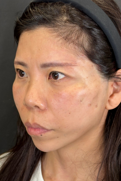 Postoperative Condition Part 1