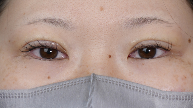 Postoperative Condition Part 1