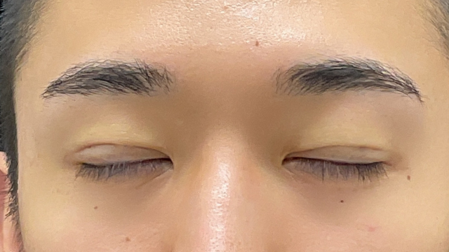 Postoperative Condition Part 1