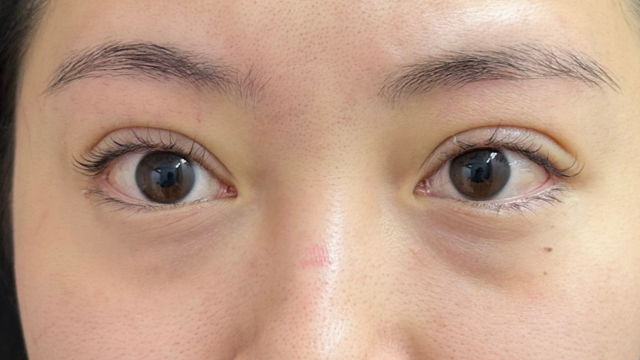 Postoperative Condition Part 1