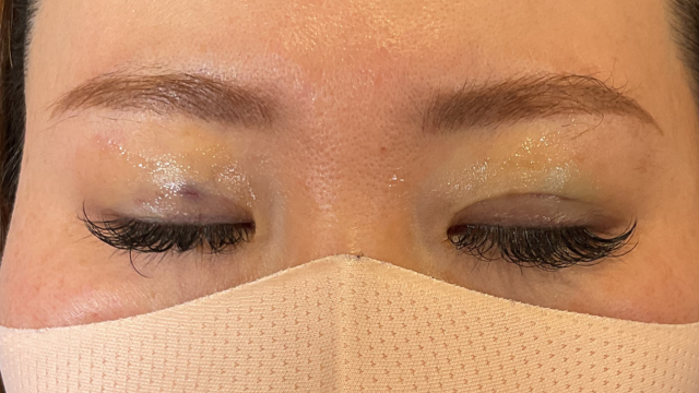 Postoperative Condition Part 1