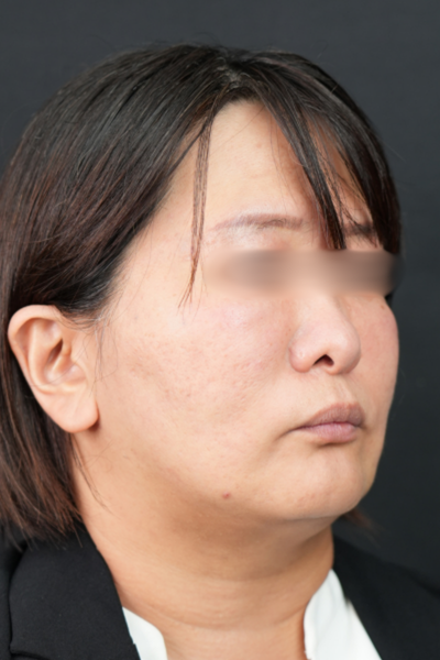 Postoperative Condition Part 1