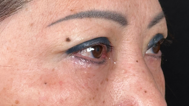 Postoperative Condition Part 1