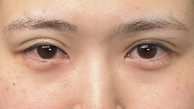 Postoperative Condition Part 1