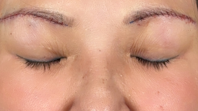 Postoperative Condition Part 1