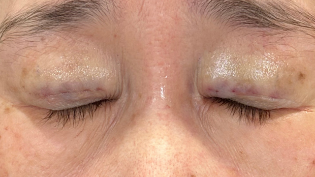 Postoperative Condition Part 1