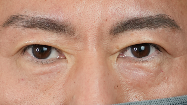 Postoperative Condition Part 1