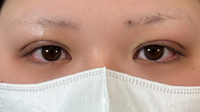 Postoperative Condition Part 1