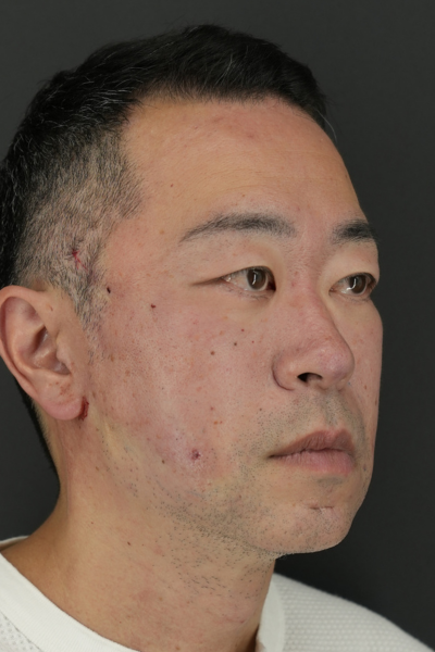 Postoperative Condition Part 1