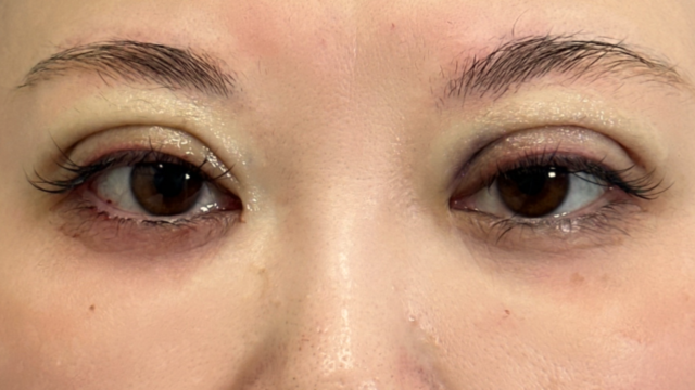 Postoperative Condition Part 1