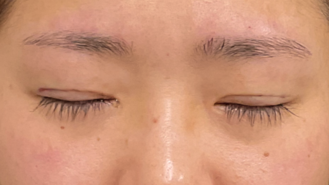 Postoperative Condition Part 1