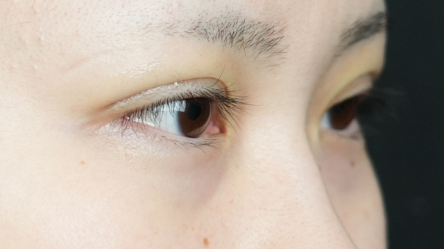 Postoperative Condition Part 1