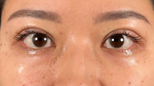 Postoperative Condition Part 1