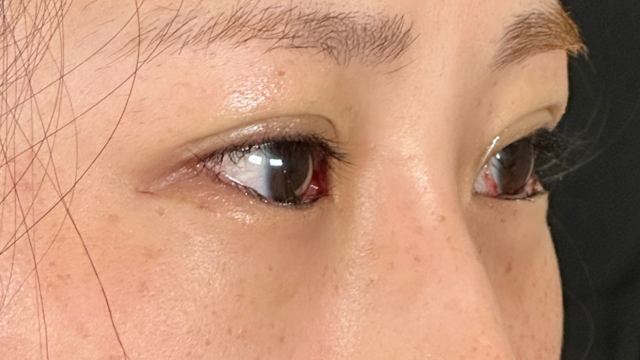 Postoperative Condition Part 1