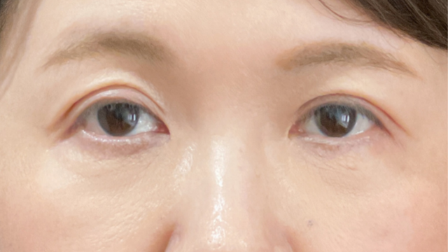 Postoperative Condition Part 1