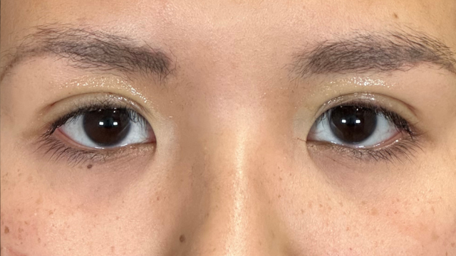 Postoperative Condition Part 1