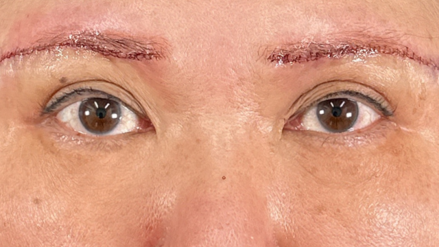 Postoperative Condition Part 1