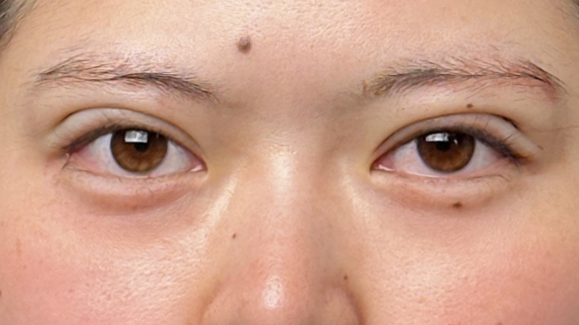 Postoperative Condition Part 1