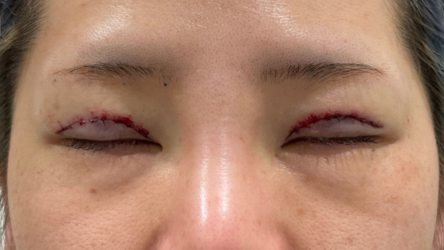 Postoperative Condition Part 1