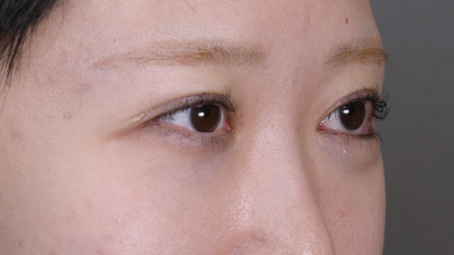 Postoperative Condition Part 1