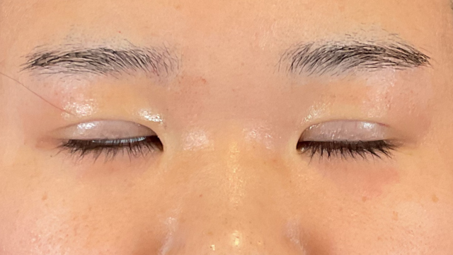 Postoperative Condition Part 1