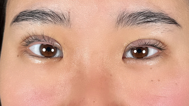 Postoperative Condition Part 1