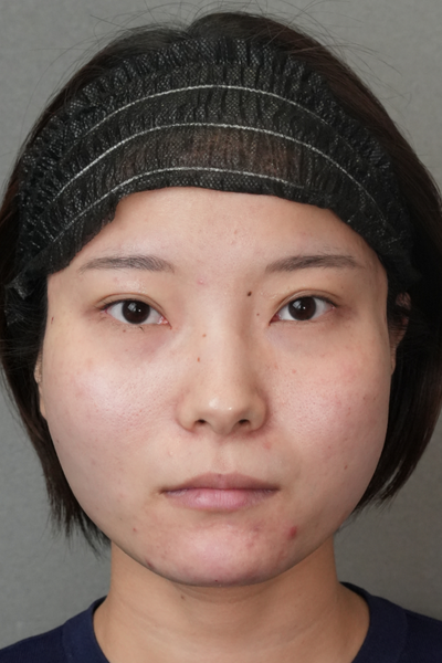 Postoperative Condition Part 1