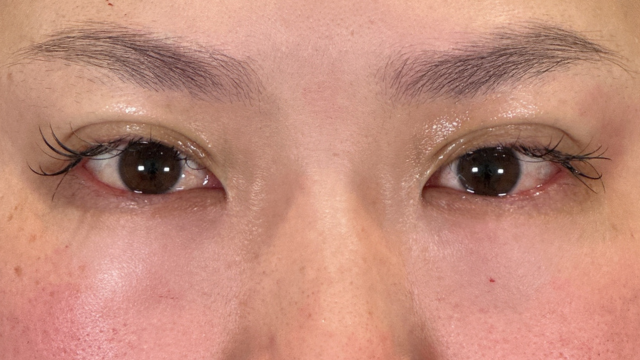 Postoperative Condition Part 1