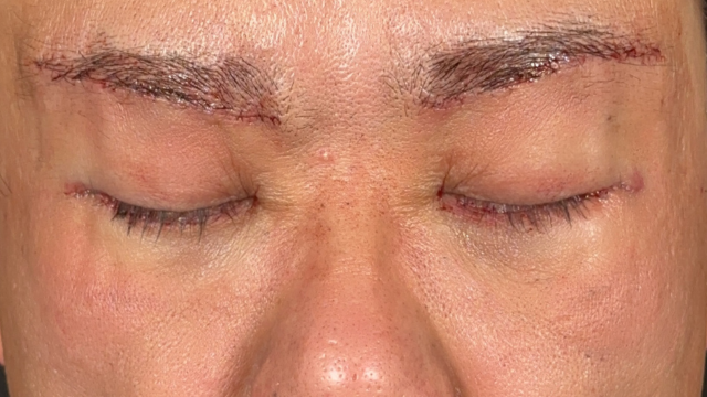 Postoperative Condition Part 1