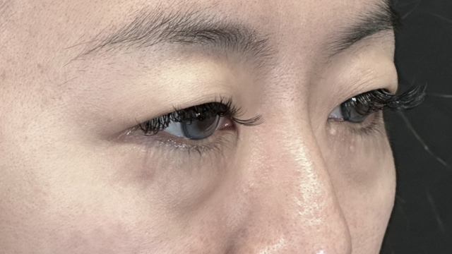 Postoperative Condition Part 1