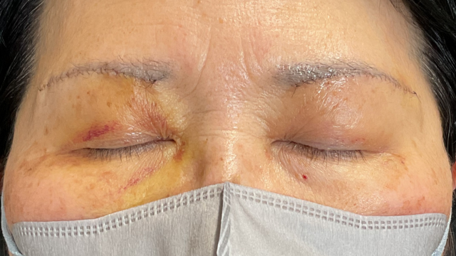 Postoperative Condition Part 1