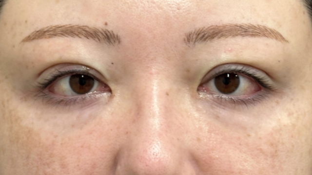 Postoperative Condition Part 1