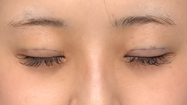 Postoperative Condition Part 1