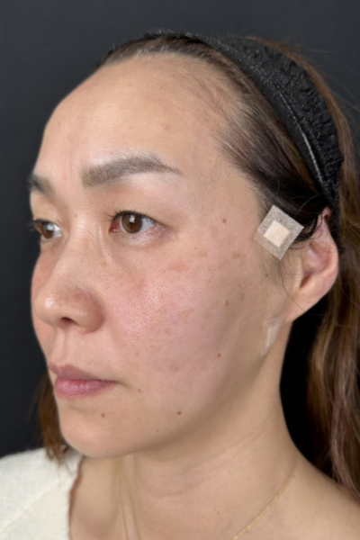 手術前の状態 その1