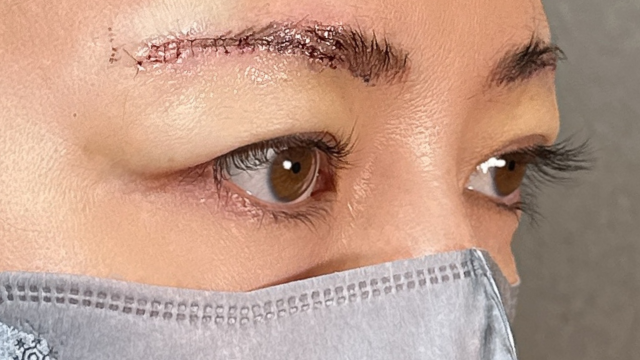 Postoperative Condition Part 1