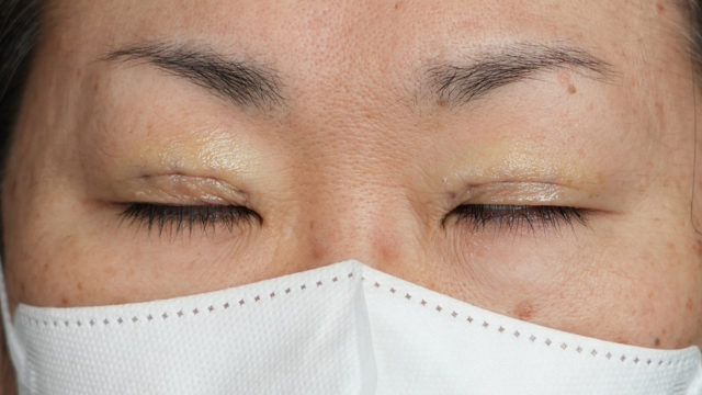 Postoperative Condition Part 1