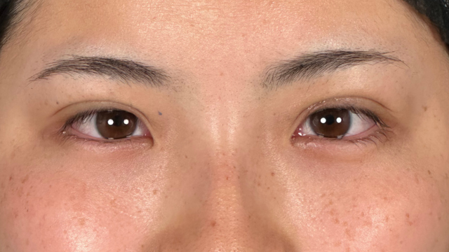 Postoperative Condition Part 1