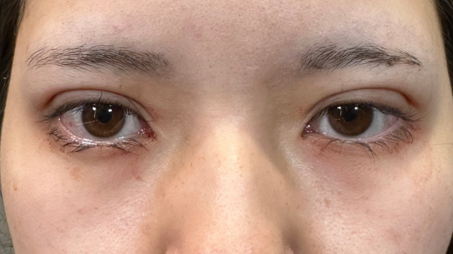 Postoperative Condition Part 1