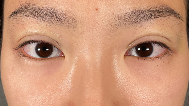 Postoperative Condition Part 1