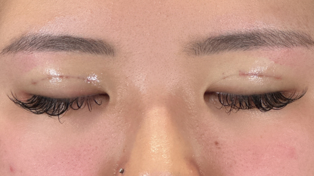 Postoperative Condition Part 1