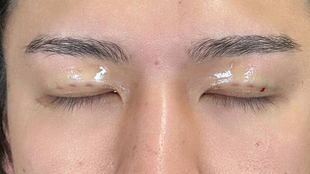 Postoperative Condition Part 1