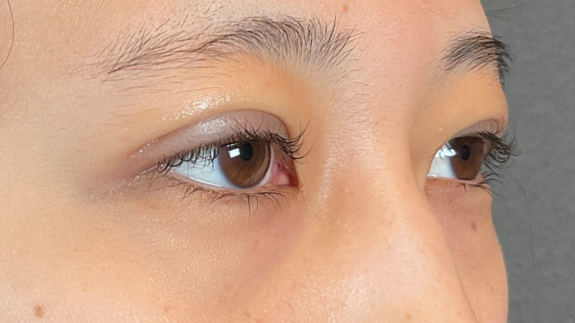 Postoperative Condition Part 1