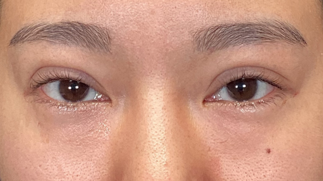 Postoperative Condition Part 1