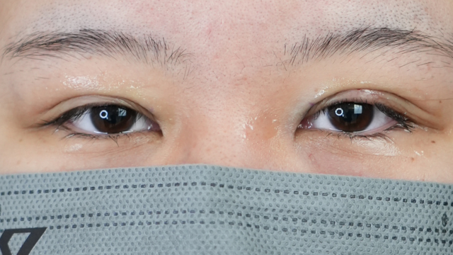 Postoperative Condition Part 1