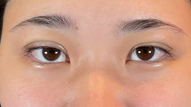 Postoperative Condition Part 1