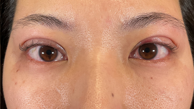 Postoperative Condition Part 1