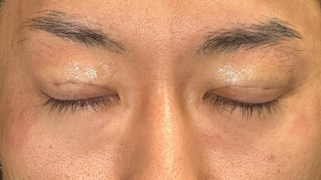 Postoperative Condition Part 1