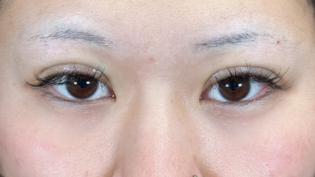 Postoperative Condition Part 1